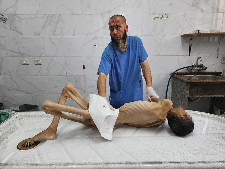Netanyahu’nun İmzası: 15 Kilo Ceset