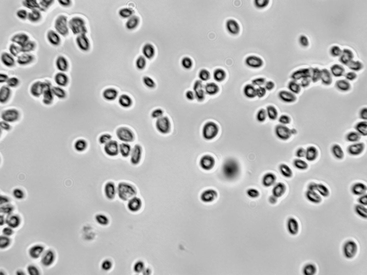 Bread Yeast (Saccharomyces cerevisiae)