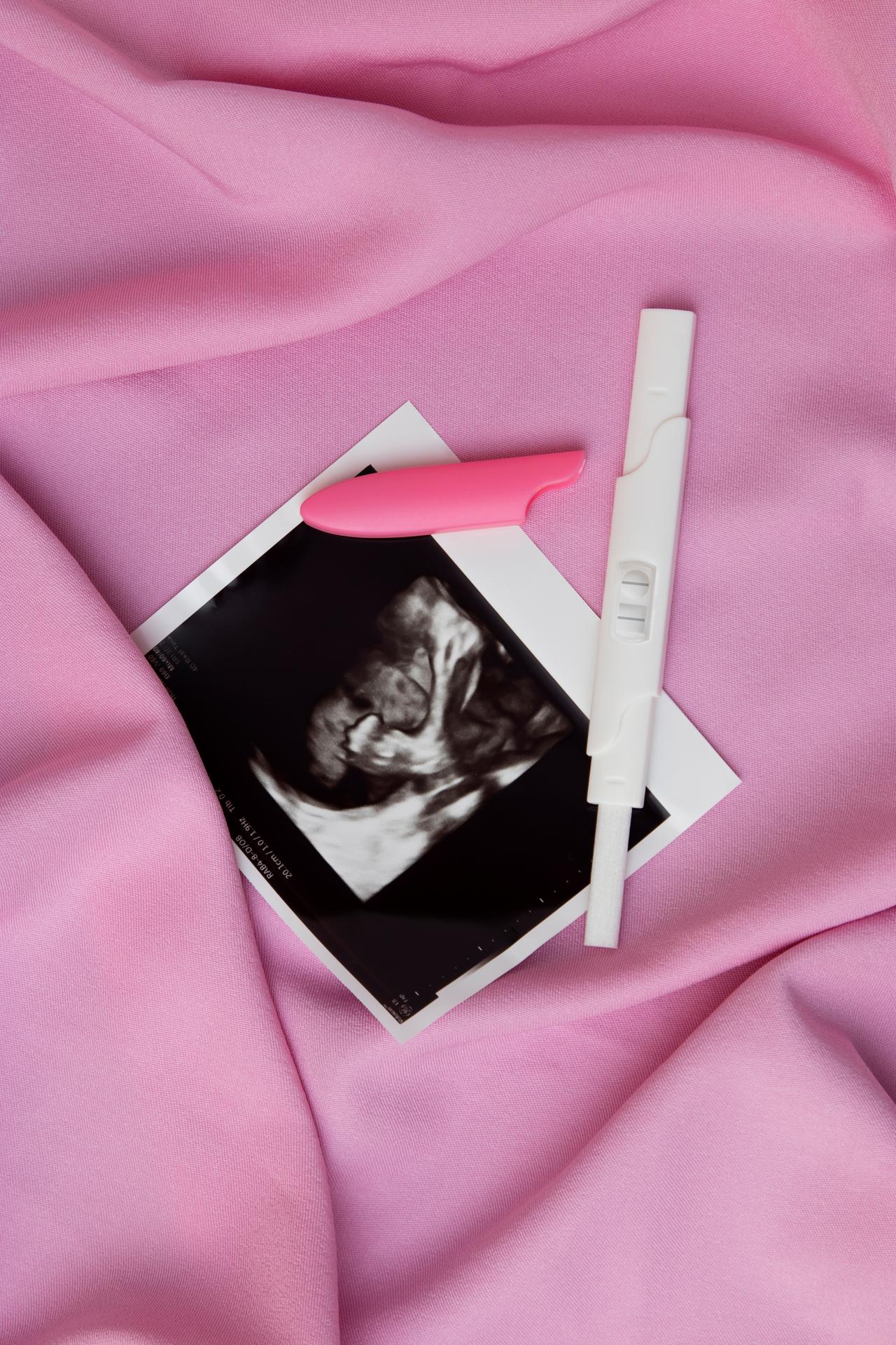 top-view-positive-pregnancy-test-ultrasound.jpg