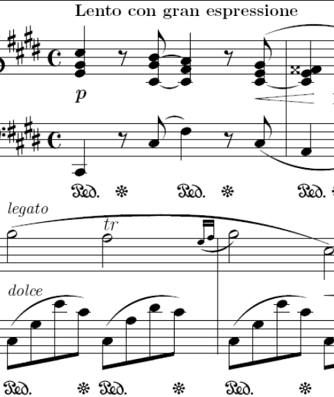 Nocturne in C-sharp minor (Op. posth.)