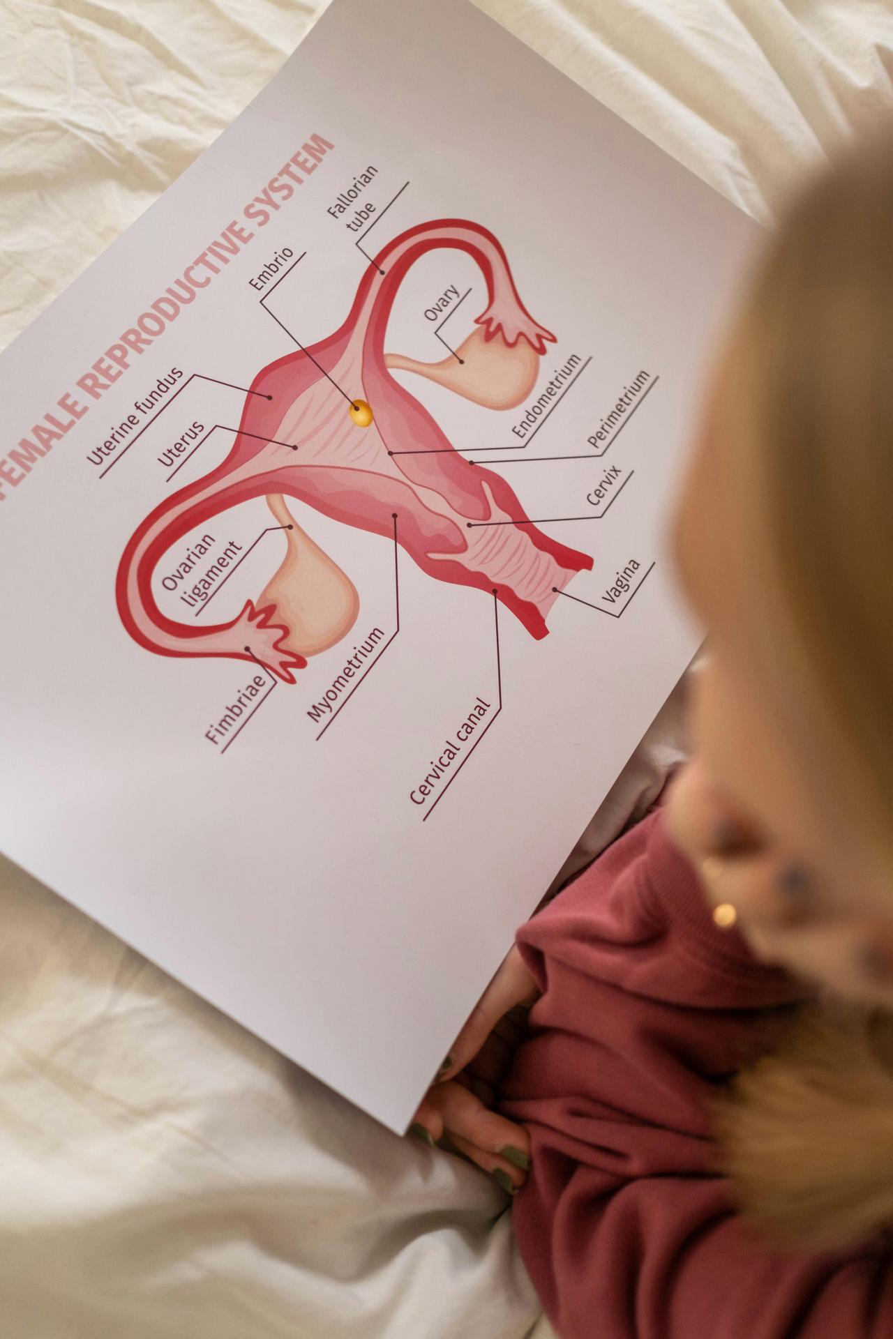 Polycystic Ovary Syndrome (PCOS)